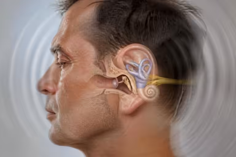 découvrez comment les troubles de l'oreille interne peuvent provoquer des vertiges et apprenez à reconnaître les symptômes pour mieux les gérer.