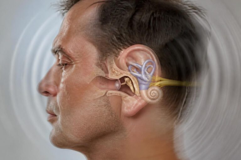 découvrez comment les troubles de l'oreille interne peuvent provoquer des vertiges et apprenez à reconnaître les symptômes pour mieux les gérer.