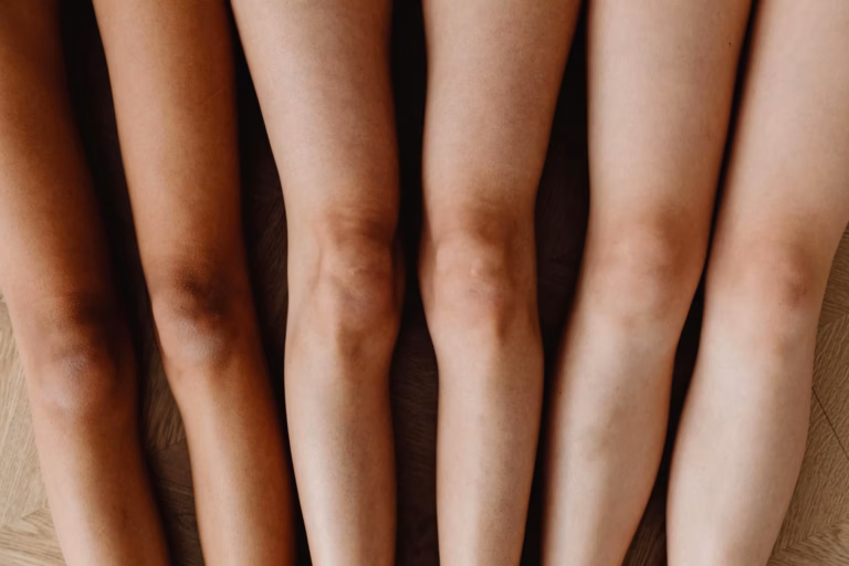 Visage qui ne bronze pas : pourquoi et que faire