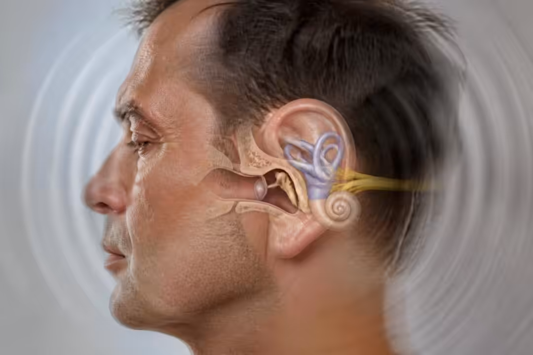 découvrez comment les troubles de l'oreille interne peuvent provoquer des vertiges et apprenez à reconnaître les symptômes pour mieux les gérer.